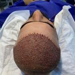 کلینیک کاشت ابرو و مو عزیزی در شیراز