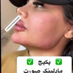 کلینیک لیزر و زیبایی مهسان