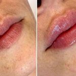 مرکز لیزر و کلینیک پوست مو زیبایی سپید