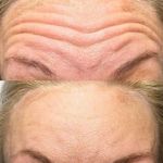 مرکز لیزر و کلینیک پوست مو زیبایی سپید