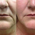 مرکز لیزر و کلینیک پوست مو زیبایی سپید