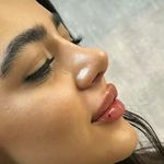 کلینیک زیبایی و لیزر دکتر رز