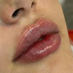 کلینیک زیبایی و لیزر دکتر رز