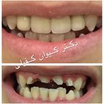 کیوان کفیلی