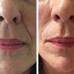 مرکز لیزر و کلینیک پوست مو زیبایی سپید