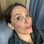 کلینیک پوست مو زیبایی حورا
