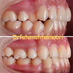 متخصص ارتودنسی اصفهان