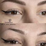 میکروبلیدینگ_ندا