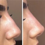 مرکز لیزر و کلینیک پوست مو زیبایی سپید