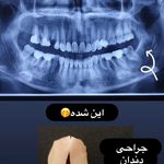 دندانپزشکی حامی (طرف قراردادبیمه نیستیم)