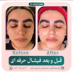 آرایشگاه زنانه إلماه