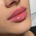 کلینیک لیزر و زیبایی مهسان