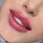 کلینیک لیزر و زیبایی مهسان