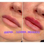 مرکز لیزر و کلینیک پوست مو زیبایی سپید