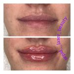 مرکز لیزر و کلینیک پوست مو زیبایی سپید