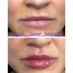 مرکز لیزر و کلینیک پوست مو زیبایی سپید