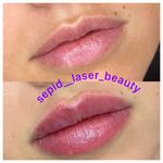 مرکز لیزر و کلینیک پوست مو زیبایی سپید