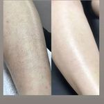 مرکز لیزر موهای زائد لطفی