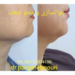 کلینیک زیبایی مرکز لیزر دکترپروانه نوری