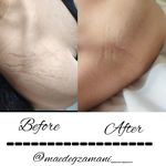 پاکسازی پوست مائده