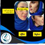 مرکزکلینیک لیزر زیبایی پوست و مو آسا