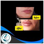 مرکزکلینیک لیزر زیبایی پوست و مو آسا