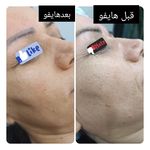 کلینیک زیبایی و لاغری فرهمند