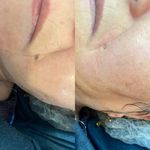 مرکز لیزر و زیبایی دکتر یعقوب اصفهانی