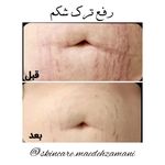 پاکسازی پوست مائده