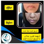 مرکزکلینیک لیزر زیبایی پوست و مو آسا