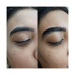 کاشت مژه و کاشت ناخن