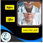 مرکزکلینیک لیزر زیبایی پوست و مو آسا
