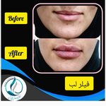 مرکزکلینیک لیزر زیبایی پوست و مو آسا