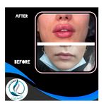 مرکزکلینیک لیزر زیبایی پوست و مو آسا