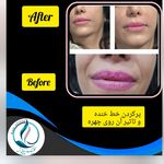 مرکزکلینیک لیزر زیبایی پوست و مو آسا