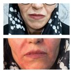 مرکزکلینیک لیزر زیبایی پوست و مو آسا