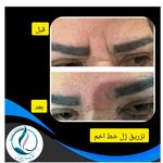 مرکزکلینیک لیزر زیبایی پوست و مو آسا