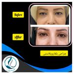 مرکزکلینیک لیزر زیبایی پوست و مو آسا