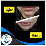 مرکزکلینیک لیزر زیبایی پوست و مو آسا