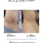 پاکسازی پوست مائده