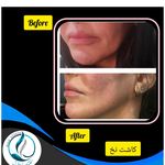 مرکزکلینیک لیزر زیبایی پوست و مو آسا