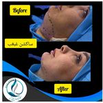 مرکزکلینیک لیزر زیبایی پوست و مو آسا