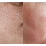 پاکسازی پوست مائده