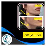 مرکزکلینیک لیزر زیبایی پوست و مو آسا