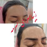 زیبا سرای سرمه