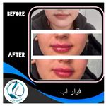 مرکزکلینیک لیزر زیبایی پوست و مو آسا