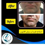 مرکزکلینیک لیزر زیبایی پوست و مو آسا