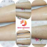 اپیلاسیون تخصصی بدن بانوان در ساری