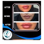 مرکزکلینیک لیزر زیبایی پوست و مو آسا