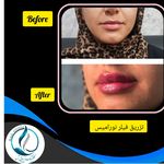 مرکزکلینیک لیزر زیبایی پوست و مو آسا